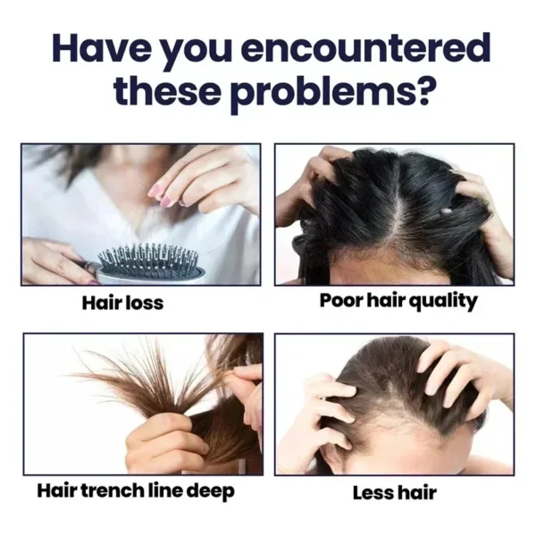 Hair Growth Essential Loss Regrowth Treatment - Image 4