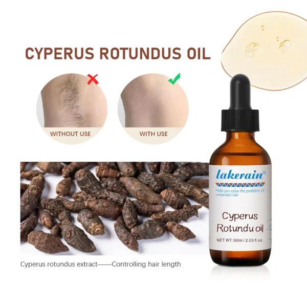 Semi-permanent Cyperus Rotundus Oil Hair Remover