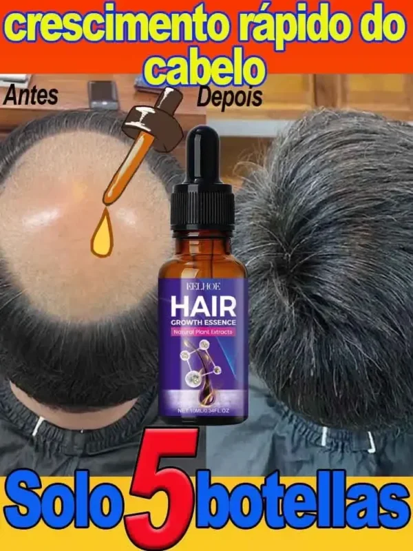Hair Growth Essential Loss Regrowth Treatment