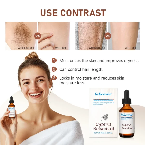 Semi-permanent Cyperus Rotundus Oil Hair Remover - Image 2