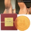 Body Whitening Soap Deep Clean Skin Chicken Skin Removal