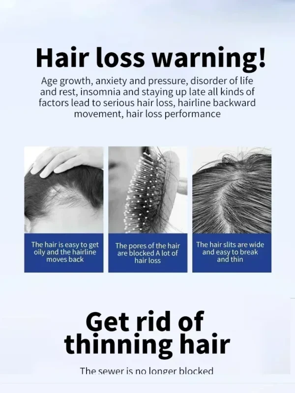 Hair Growth Essential Loss Regrowth Treatment - Image 2