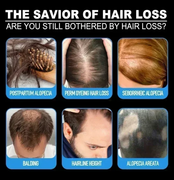Hair Growth Essential Loss Regrowth Treatment - Image 3