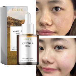 Salicylic Acid Pore Shrinking Serum Reduce Large