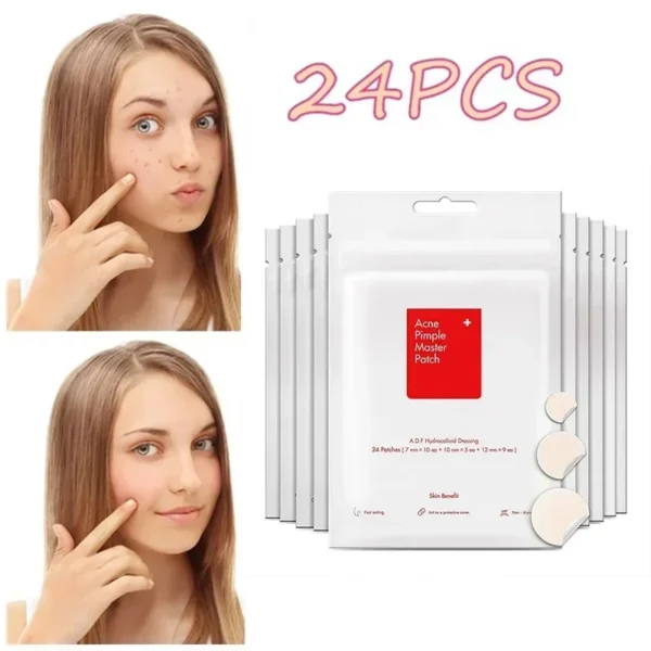 24pcs Face Acne Pimple Spot Facial Skin Care Blackhead Removal