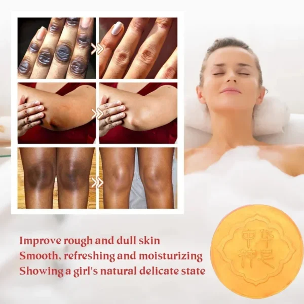 Body Whitening Soap Deep Clean Skin Chicken Skin Removal - Image 4