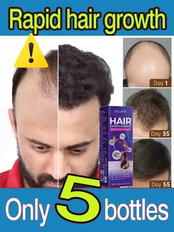 Hair Growth Essential Loss Regrowth Treatment