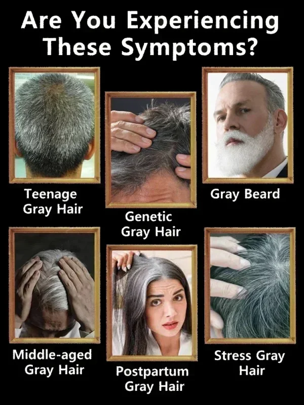 Natural Anti Gray Hair Serum Nourishing Hair Care - Image 2